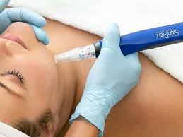 SkinPen Microneedling